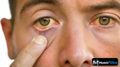 Leicht gelbe Augen am Rand